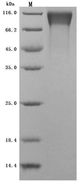 SDS-PAGE