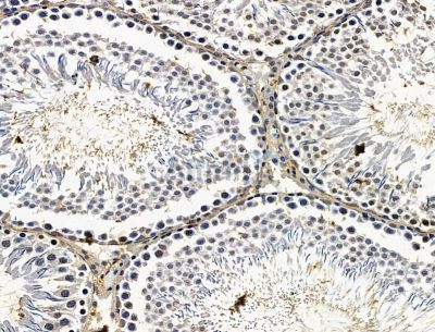 Валидация Affinity DF15202 - 11471