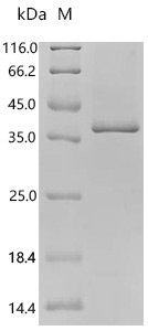 SDS-PAGE
