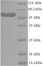 SDS-PAGE