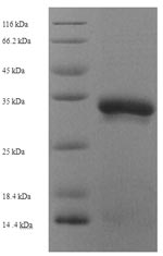 SDS-PAGE