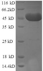 SDS-PAGE