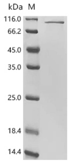 SDS-PAGE