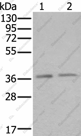 Вестерн-блоттинг, ATXN7L3, клетки HeLa и Raji