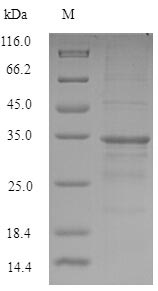 SDS-PAGE