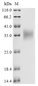 SDS-PAGE