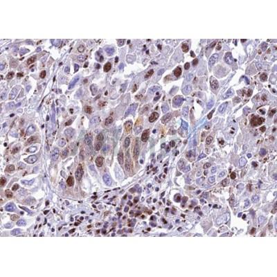 Валидация Affinity DF12020 - 6036