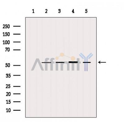 Валидация Affinity AF5161 - 2567