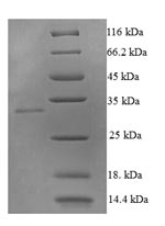 SDS-PAGE