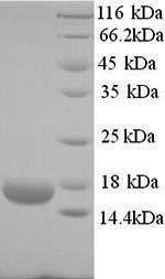 SDS-PAGE