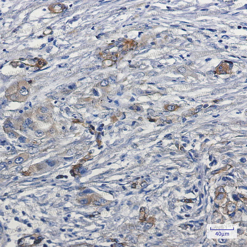 Валидация AntibodySystem RHA78301