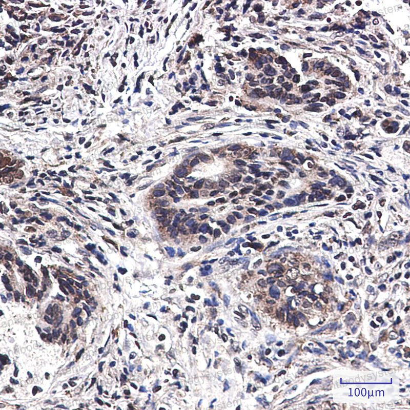 Валидация AntibodySystem RHD72401