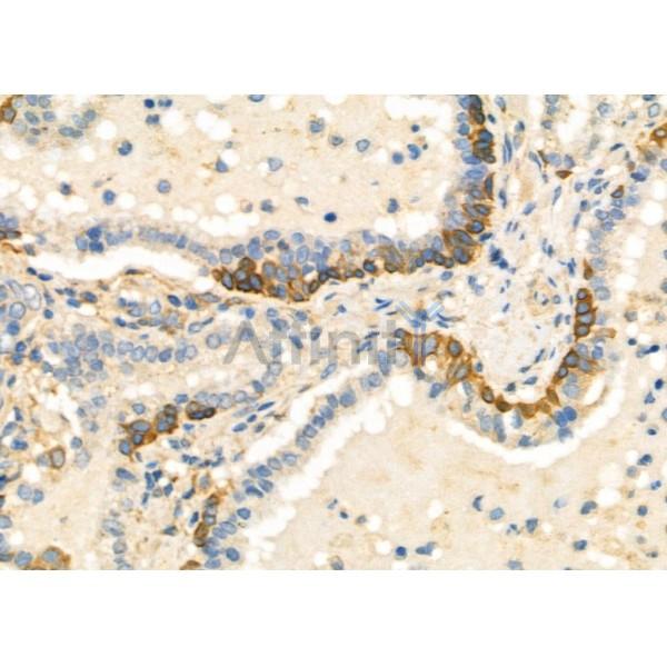 Валидация Affinity DF6813 - 18386