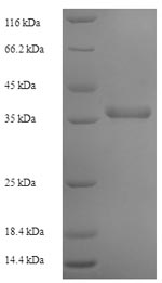 SDS-PAGE