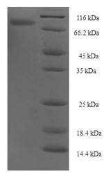 SDS-PAGE
