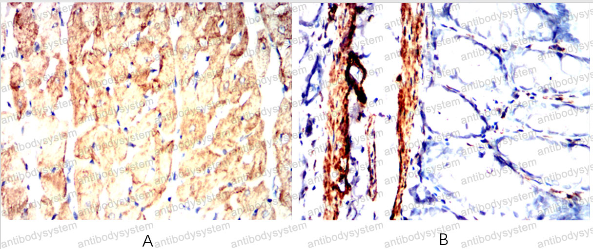 Валидация AntibodySystem RHD25502