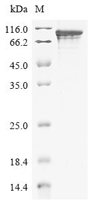 SDS-PAGE