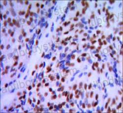 Валидация AntibodySystem RHD14403