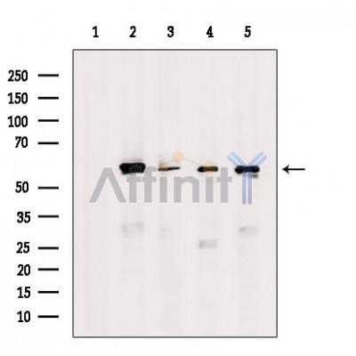 Валидация Affinity DF7243 - 18895