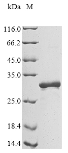 SDS-PAGE
