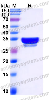 EHJ17901, SDS-PAGE