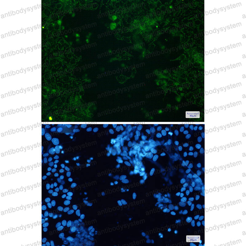 Валидация IF - AntibodySystem RHC12901