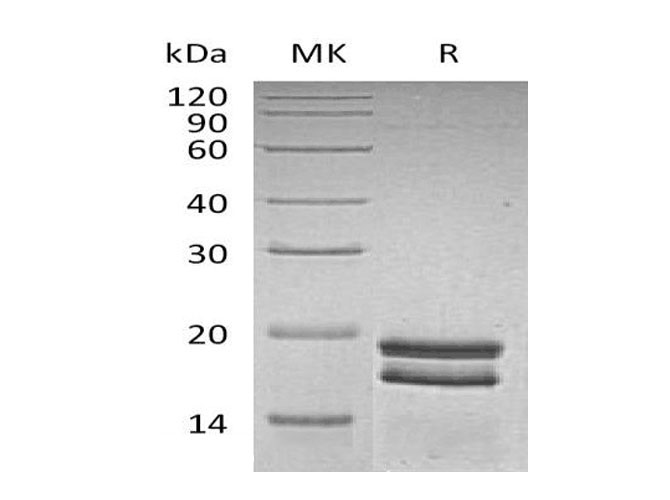 Валидация Elabscience PKSH033311(3644)
