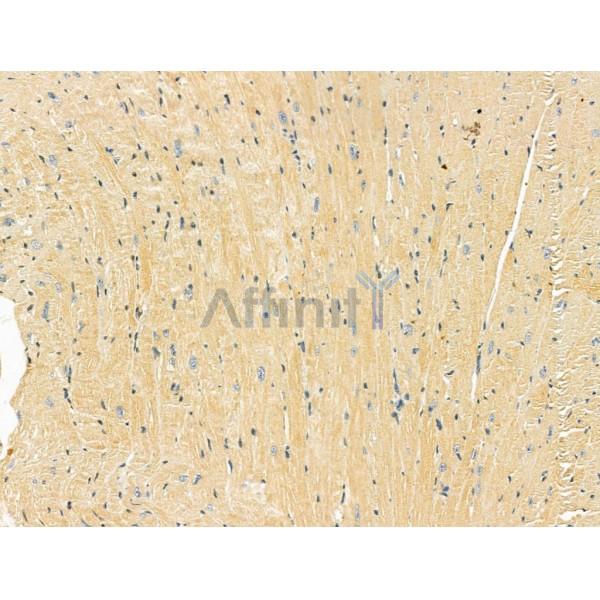 Валидация Affinity DF8642 - 20593