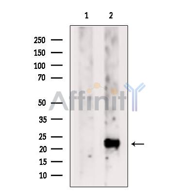 Валидация Affinity DF6231 - 17511