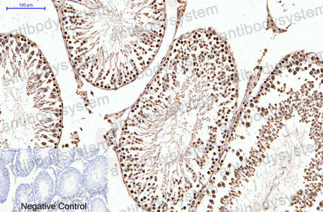 Валидация AntibodySystem RHC20005 (756)