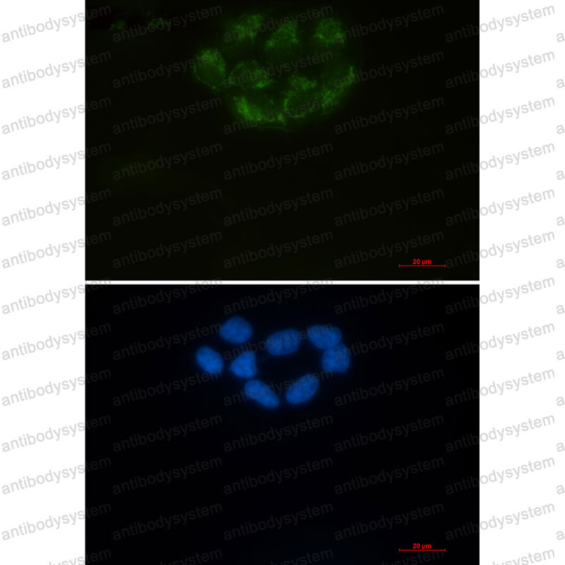 Валидация IF - AntibodySystem RHE14003