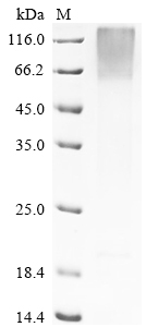 SDS-PAGE