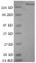 SDS-PAGE