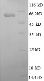SDS-PAGE