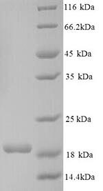 SDS-PAGE