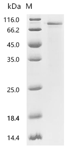 SDS-PAGE