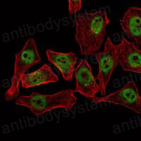 Валидация IF - AntibodySystem RHN92101