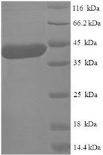 SDS-PAGE