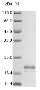 SDS-PAGE