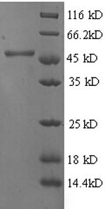 SDS-PAGE