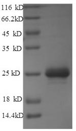 SDS-PAGE