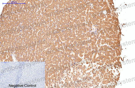 Валидация AntibodySystem RHC35004