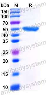 YHC29102, SDS-PAGE