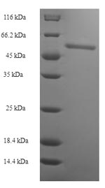 SDS-PAGE