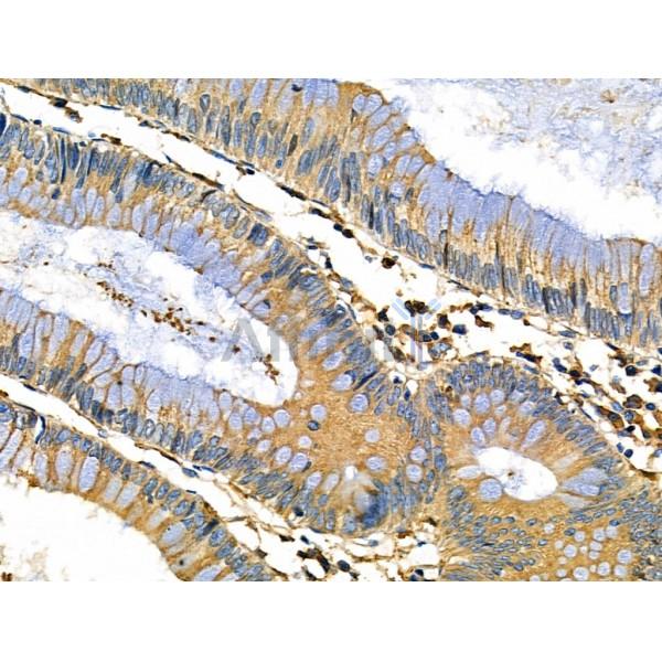 Валидация Affinity DF6211 - 17481