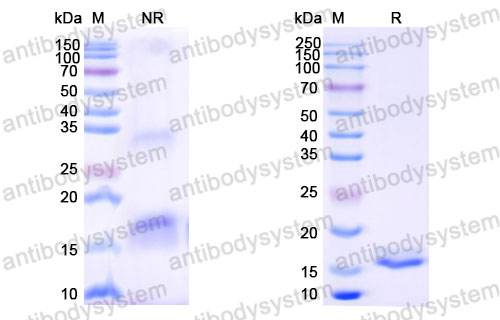 Валидация SDS-PAGE - AntibodySystem RHB86902