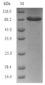 SDS-PAGE