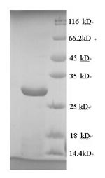SDS-PAGE
