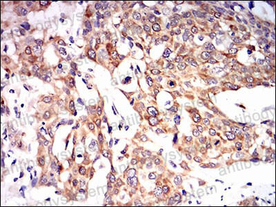 Валидация AntibodySystem RHD73103