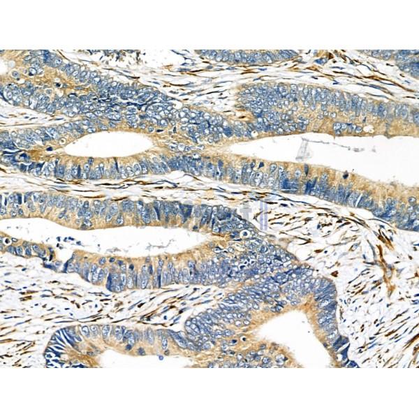 Валидация Affinity AF5111 - 2470